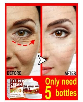 Eye Repair Cream (Pack of 2) 07ufrb-rm