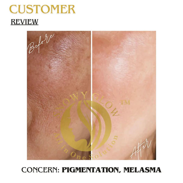 Snowy Glow face Cream 100ml Lorexa