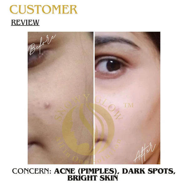 Snowy Glow face Cream 100ml Lorexa