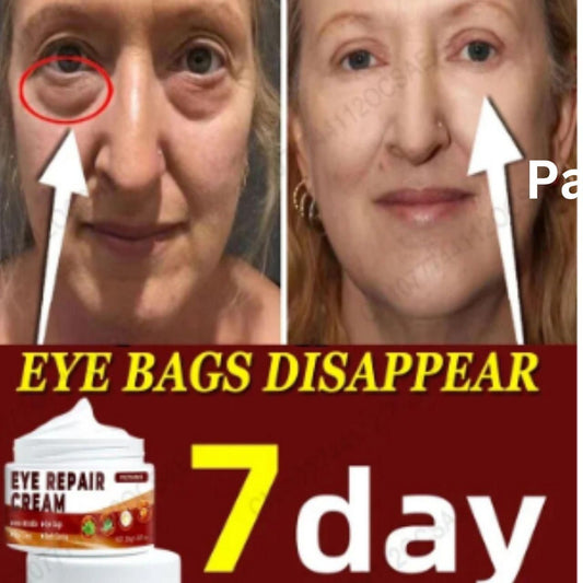 Eye Repair Cream (Pack of 2) 07ufrb-rm